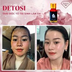 thải độc tố tái sinh làn da isamen